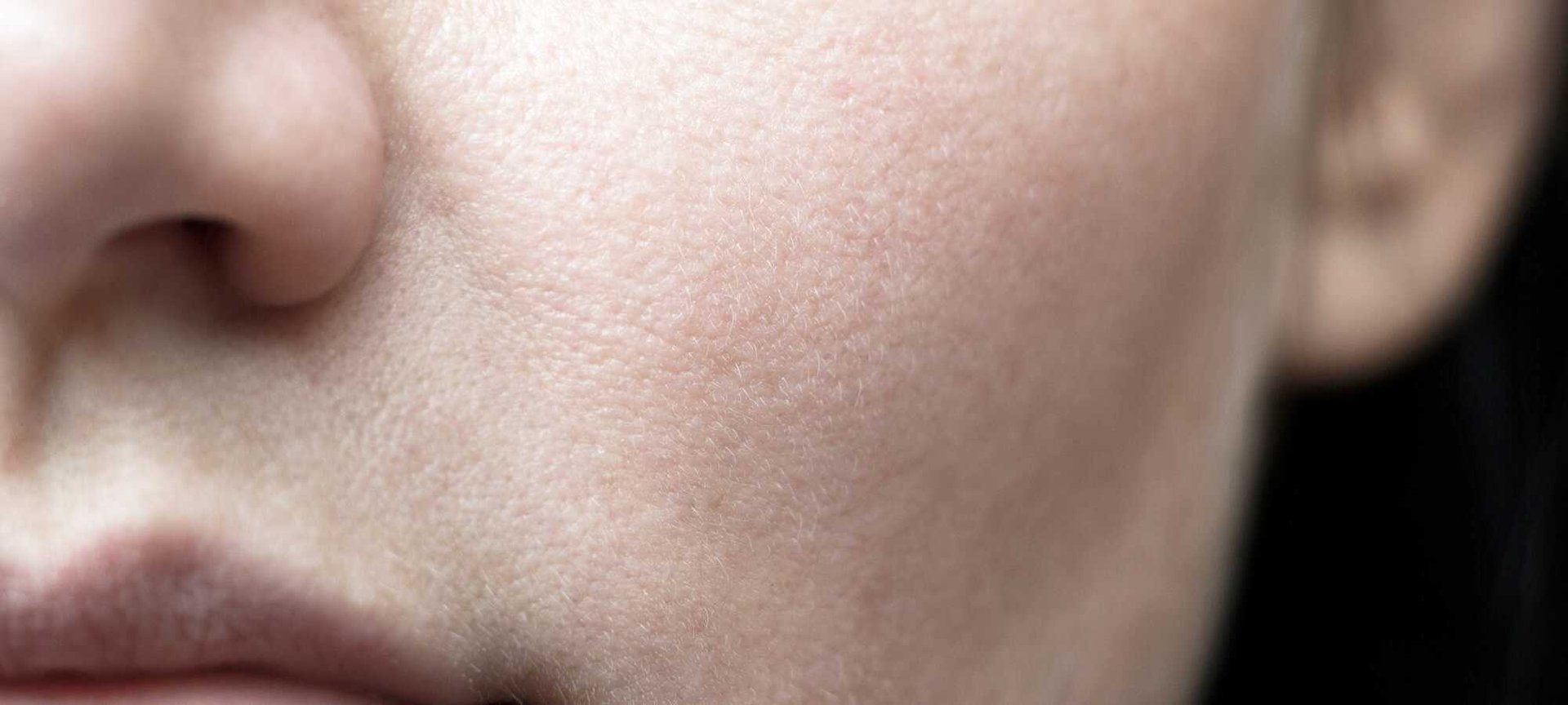 7 Powerful Ingredients For Hyperpigmentation Treatment